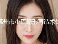 惠州市小耳畸形再造术价格表全新曝光一览(12月-5月均价为：56278元) 